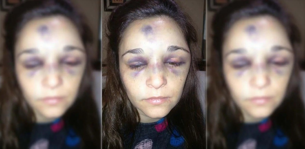Está muy grave una mujer que fue golpeada por su pareja, un boxeador de 17 años | Actualidad