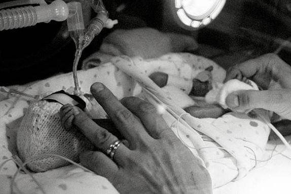 La bebé del milagro: pesó 700 gramos al nacer y fue dada de alta sin ninguna secuela | Internacionales