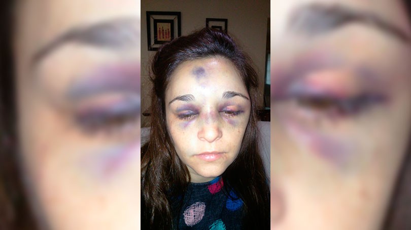 Murió una mujer tras la brutal golpiza de su novio de 17 años | Actualidad