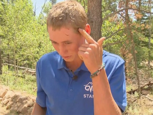 Fue de campamento y se despertó mientras un oso le mordía la cabeza | Curiosidades