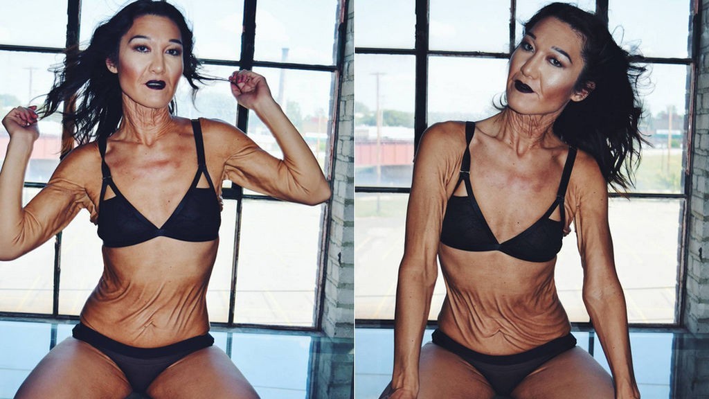 El extraño caso de la modelo de 26 años que parece una anciana por una enfermedad | Curiosidades