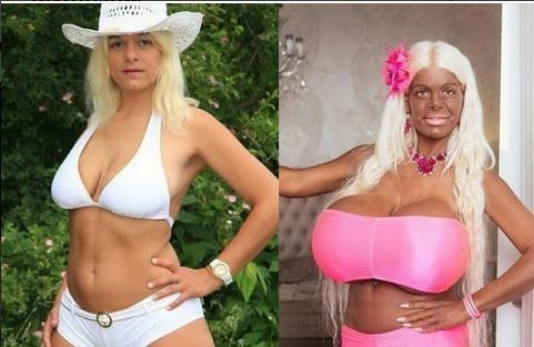 La asombrosa transformación de la "Barbie exótica": cambió el color de su piel y se agrandó los pechos | Curiosidades