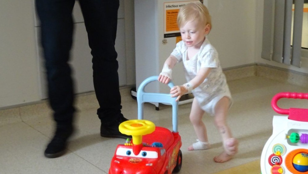 Video desgarrador: el momento en el que un nene da sus primeros pasos frente a sus padres horas antes de que le amputen una pierna | Curiosidades