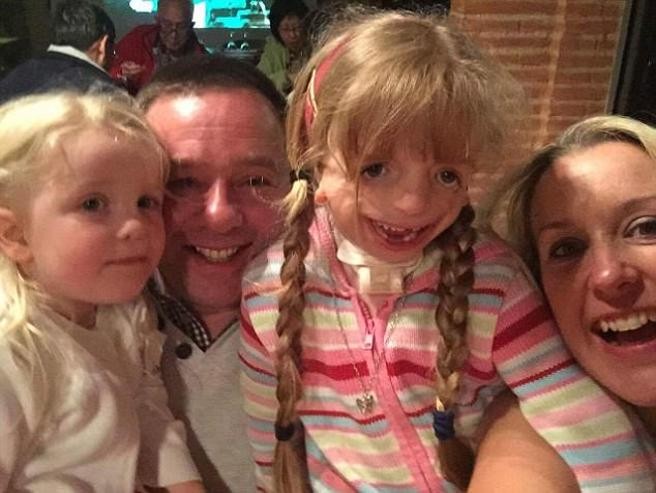 "Es una de las niñas más felices": la inspiradora historia de la nena que debió operarse 29 veces la cara | Internacionales