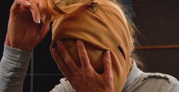 La increíble transformación de la mujer a la que le quemaron 60% del cuerpo | Internacionales