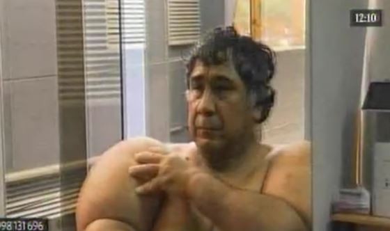 El calvario del hombre que vive con el cuerpo inflado por culpa del nitrógeno que aspiró | Curiosidades