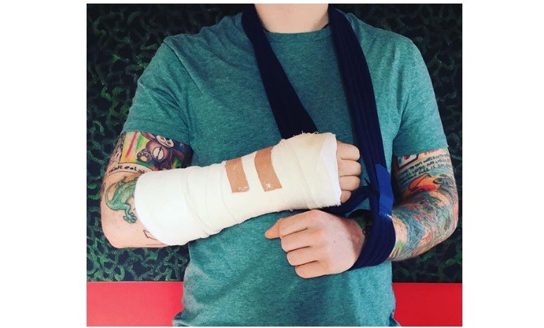 Músico quedó así tras un accidente en bicicleta y peligra su gira internacional | Espectáculos