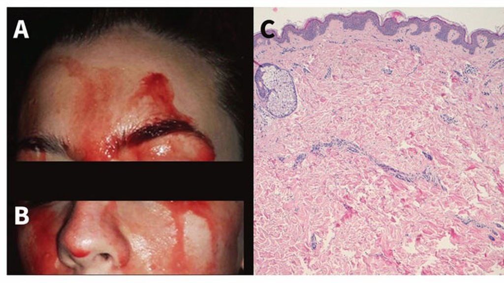 El extraño caso de la mujer que transpira sangre por las manos y la cara | Curiosidades