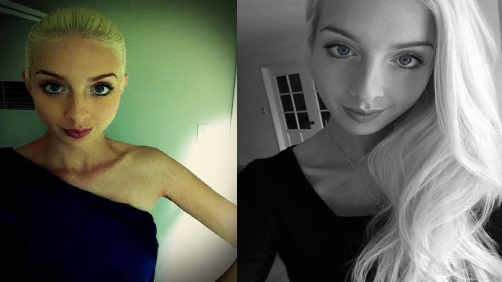 El drama de la anorexia en primera persona: "Prefería morir antes que comer" | Curiosidades