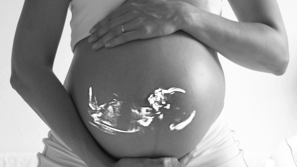 Una embarazada tiene una masa negra en el útero y arriesga la vida por su bebé | Internacionales