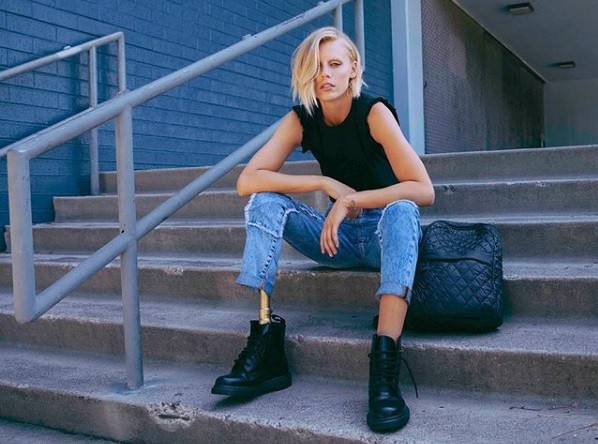 Modelo que se infectó con un tampón sufrió la amputación de su otra pierna | Internacionales