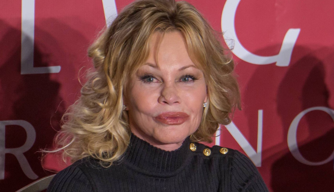 ¿Qué le pasó a Melanie Griffith en la nariz? | Espectáculos