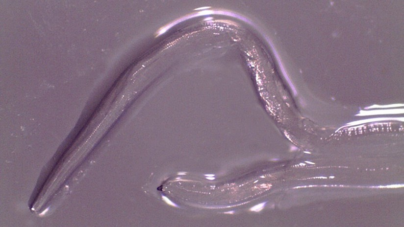 Estados Unidos: extrajeron 14 gusanos del ojo de una mujer | Curiosidades