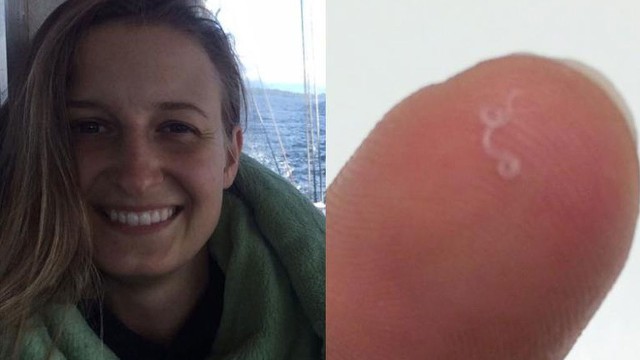 El extraño caso de la mujer que le sacaron 14 gusanos de uno de sus ojos | Internacionales