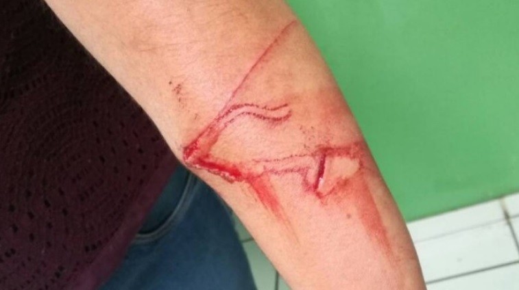 Un nene de 10 años acuchilló a su maestra para cumplir con un desafío viral | Internacionales