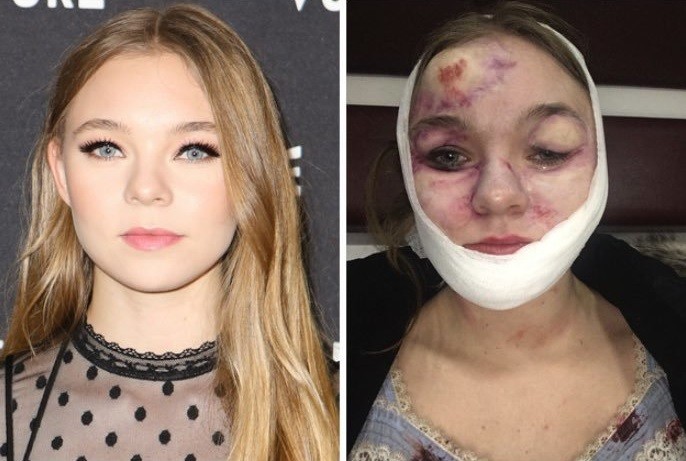 Actriz quedó desfigurada durante la filmación de una película | Espectáculos