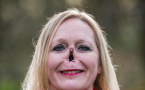 La prótesis magnética que ayuda a vivir a la mujer sin nariz | Curiosidades