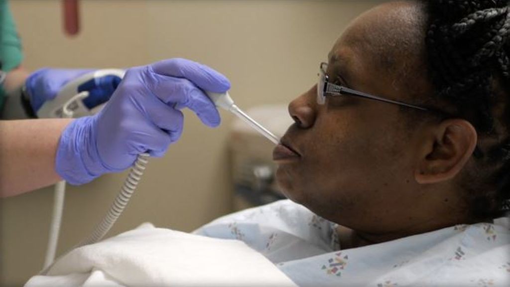 El extraño caso de la mujer perdía líquido del cerebro por la nariz | Curiosidades