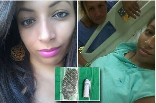 El testimonio de la brasileña que nació sin órganos reproductivos y se los reconstruyeron con piel de pescado | Curiosidades