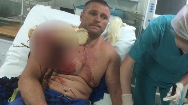 Estremecedor: cayó con su parapente y un tronco le atravesó el cuerpo | Curiosidades