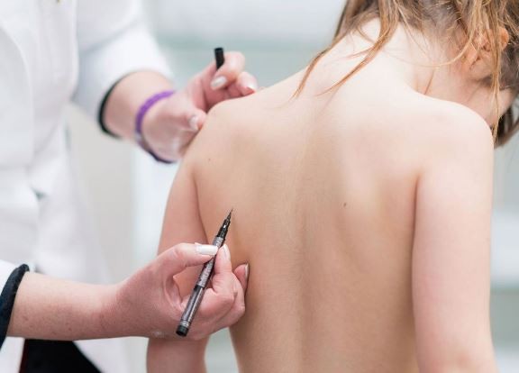 Escoliosis: buscan incluir su detección en los controles de salud de los colegios | Actualidad