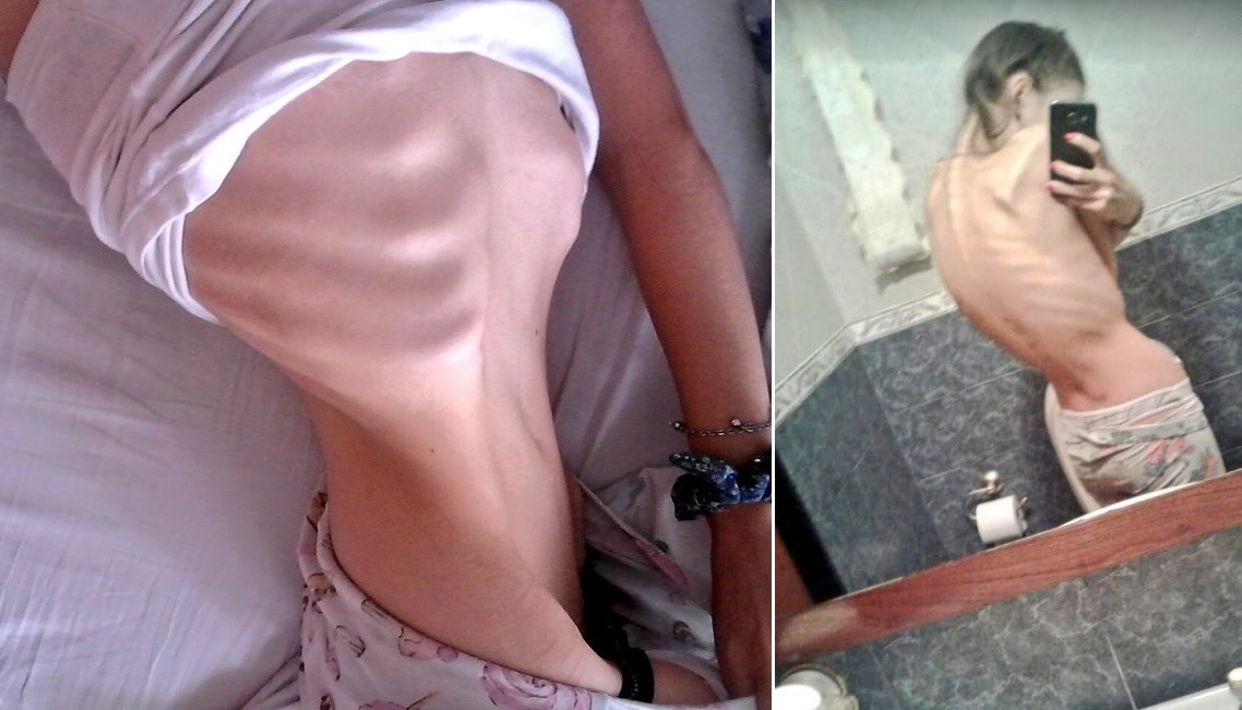 Publicó sus fotos para mostrar el peligro del "body checking" | Redes