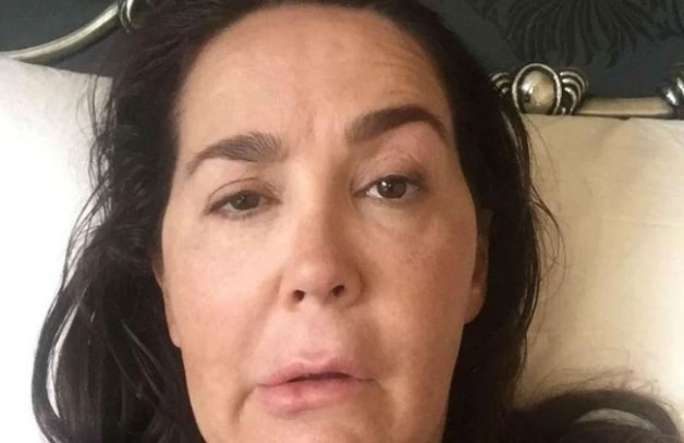 Se inyectó bótox y contrajo una bacteria: ahora sufre parálisis facial y convulsiones | Internacionales