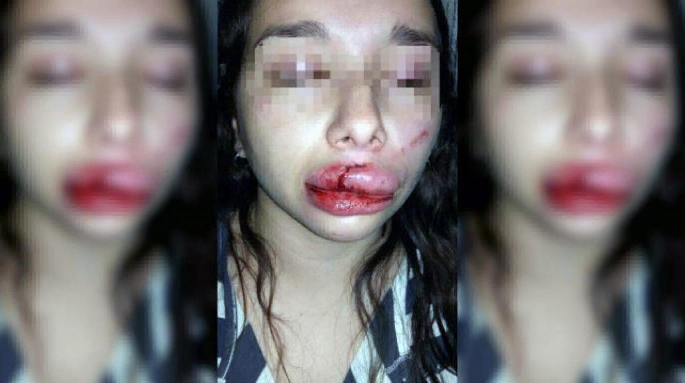 Santiago del Estero: tres hombres intentaron violarla y le desfiguraron la cara con un hierro | Actualidad