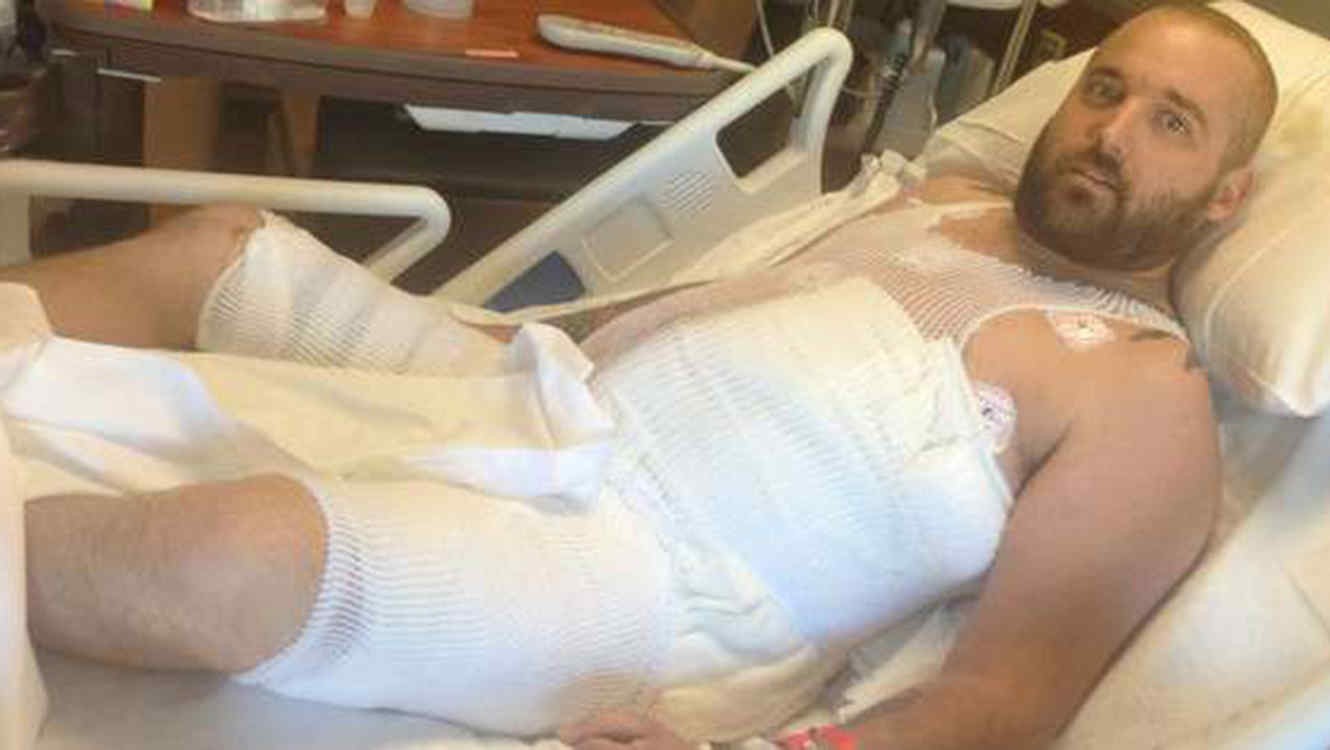 Intentó tener sexo con un cerco eléctrico y se le quemaron los genitales | Curiosidades