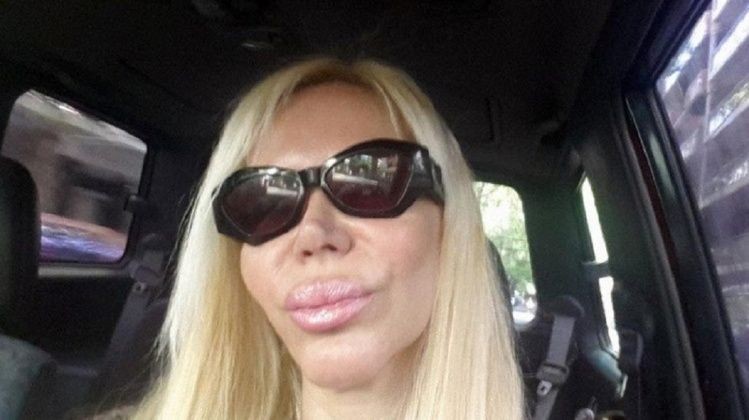 Alejandra Pradón se hizo un rejuvenecimiento vaginal para las cámaras de un reality show | Espectáculos