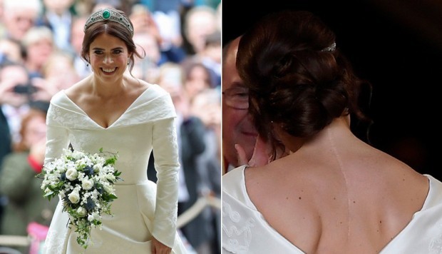 Boda Real: la impactante cicatriz que la princesa Eugenie exhibe sin problemas | Internacionales