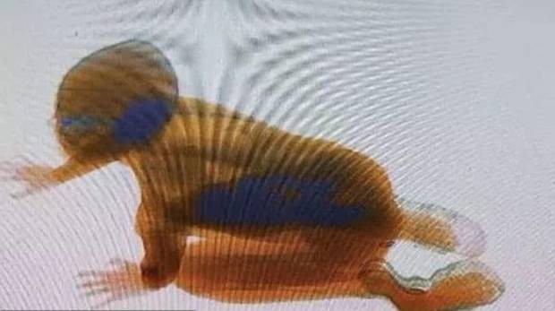 Rayos X: revisaban valijas y apareció un nene | Redes