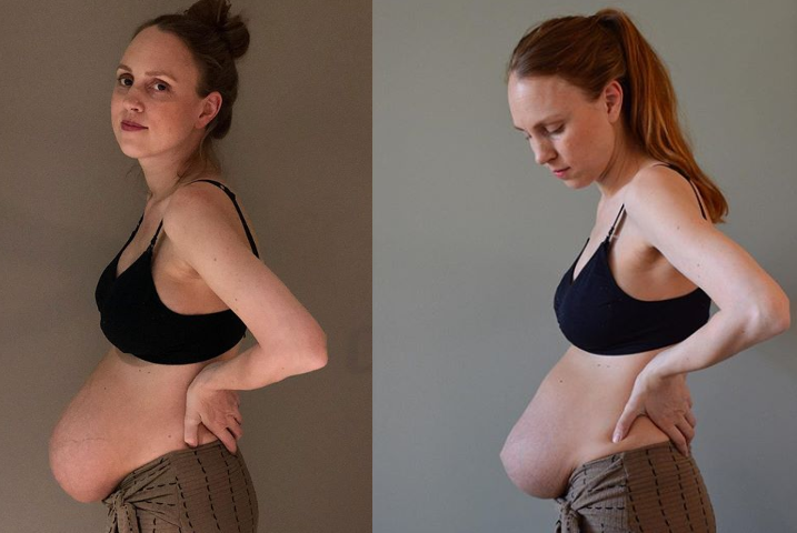 Tuvo trillizos y se volvió viral por mostrar la maternidad con una "mirada realista" | Redes