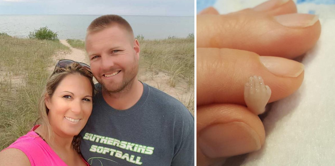 Aborto: una mujer compartió fotos de su feto muerto en Facebook para generar conciencia | Redes