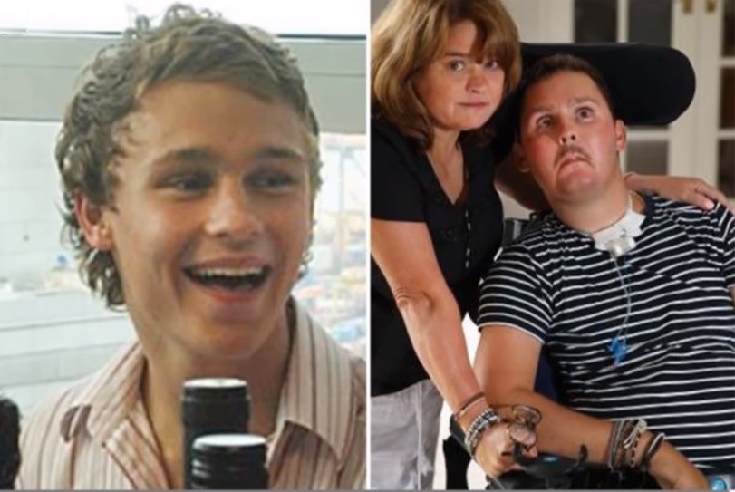 Murió el joven que había quedado tetrapléjico tras comerse una babosa | Internacionales