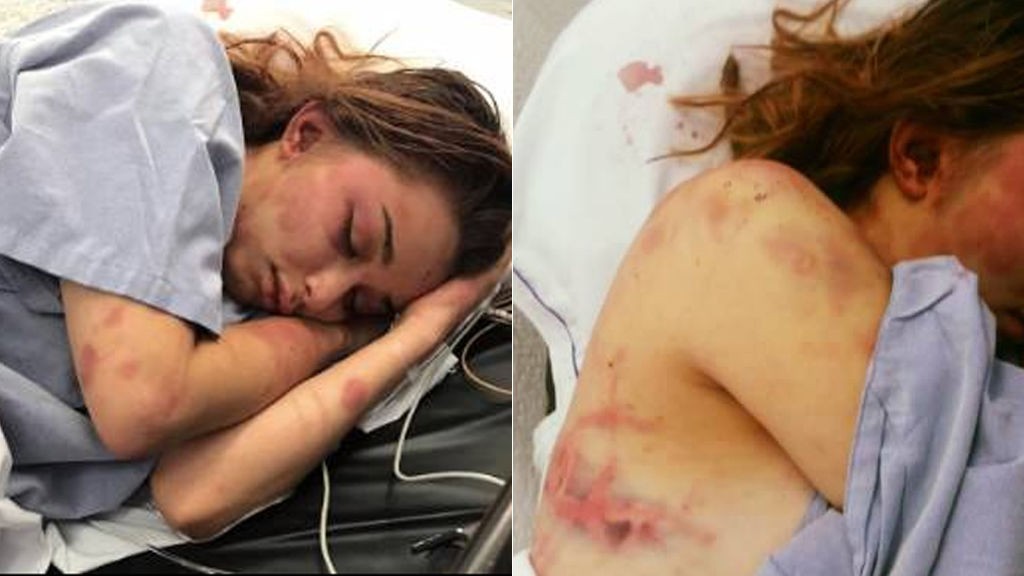 Detuvieron a un karateca por una brutal golpiza a su pareja | Internacionales