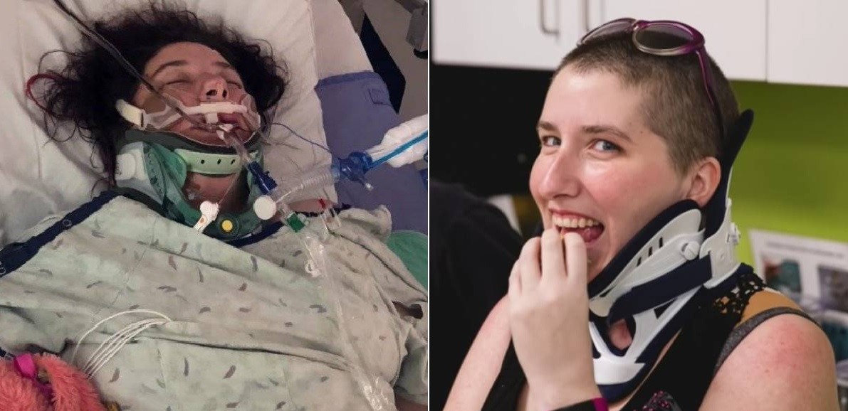 En un accidente sufrió una decapitación interna y sobrevivió | Internacionales