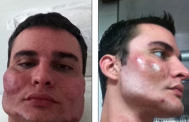 Brasil: así dejaba las caras de sus pacientes "el cirujano del terror" | Curiosidades