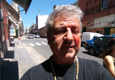 Un periodista fue agredido tras denunciar que una peluquería vendía drogas | Actualidad