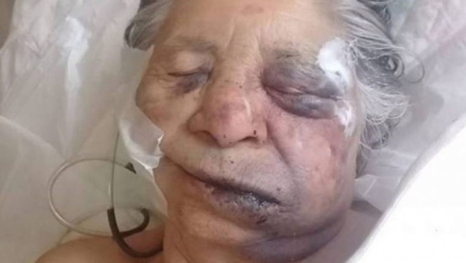 Tres detenidos por el asesinato a golpes de una mujer de 83 años | Actualidad