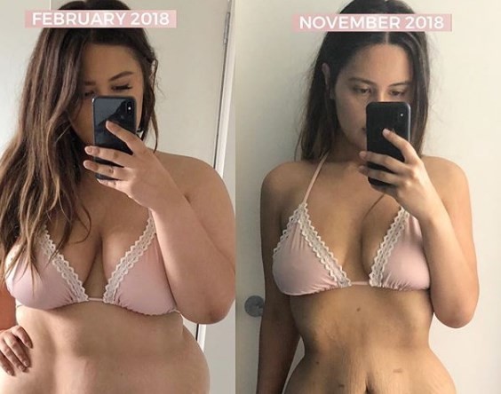 La increíble historia de la joven que bajó dos veces 60 kilos | Curiosidades