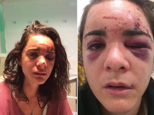 El fuerte relato de una chica que fue golpeada y violada en una parada de colectivos | Redes