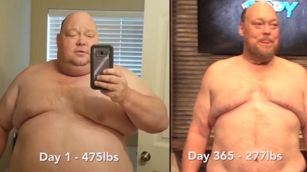 El caso del hombre que tenía obesidad mórbida y bajó 90 kilos en un año | Curiosidades