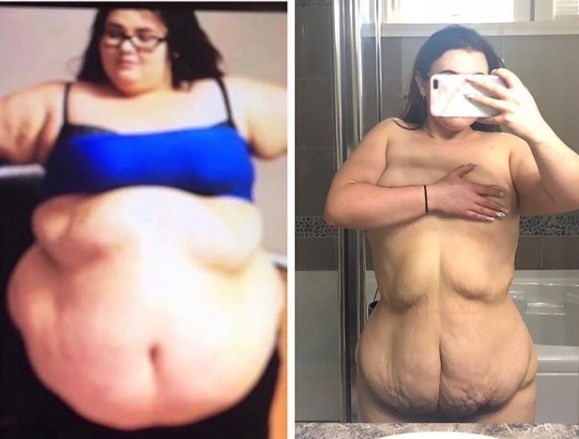 La historia de la joven que bajó 80 kilos: contó su intimidad en Instagram y se volvió viral | Redes