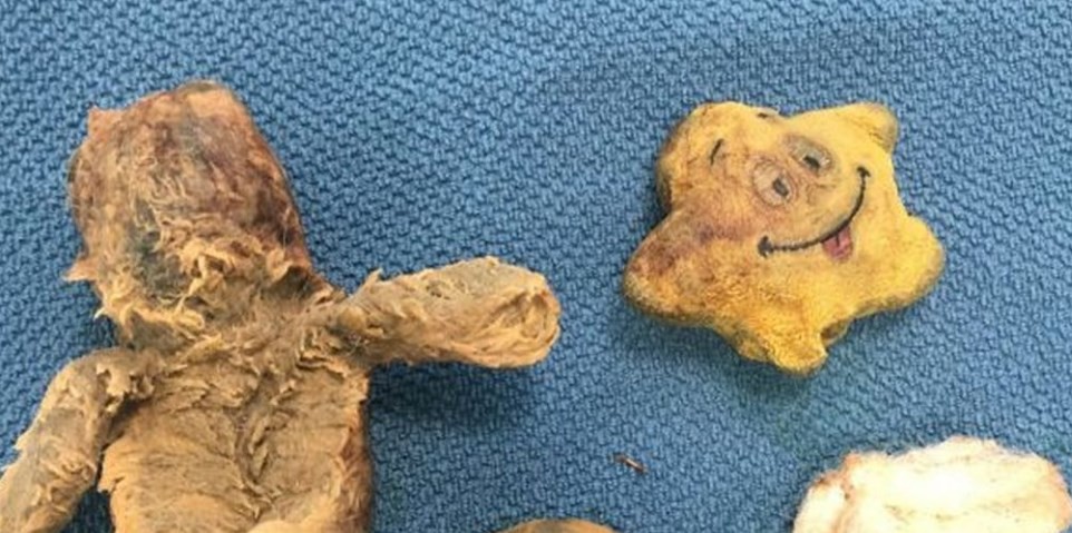 Un nene de dos años cayó de un quinto piso intentando salvar a su peluche: sobrevivió de milagro | Internacionales