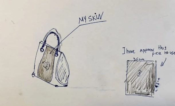 Una mujer inglesa quiere hacerse una cartera con piel de su pie amputado | Curiosidades