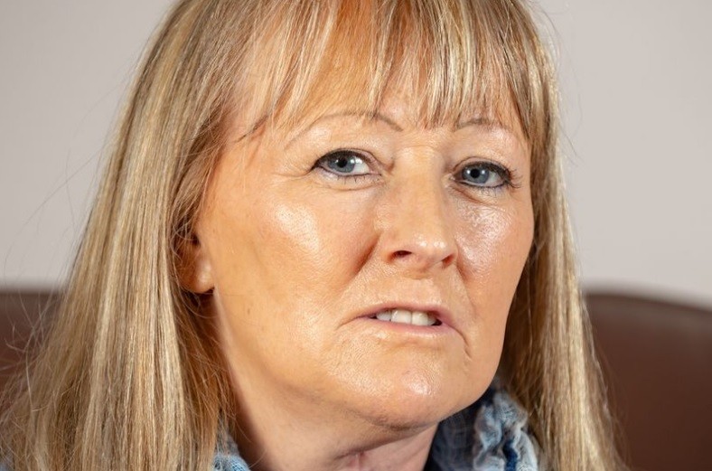 Venció al cáncer y pudieron reconstruir su lengua con piel de su brazo | Internacionales