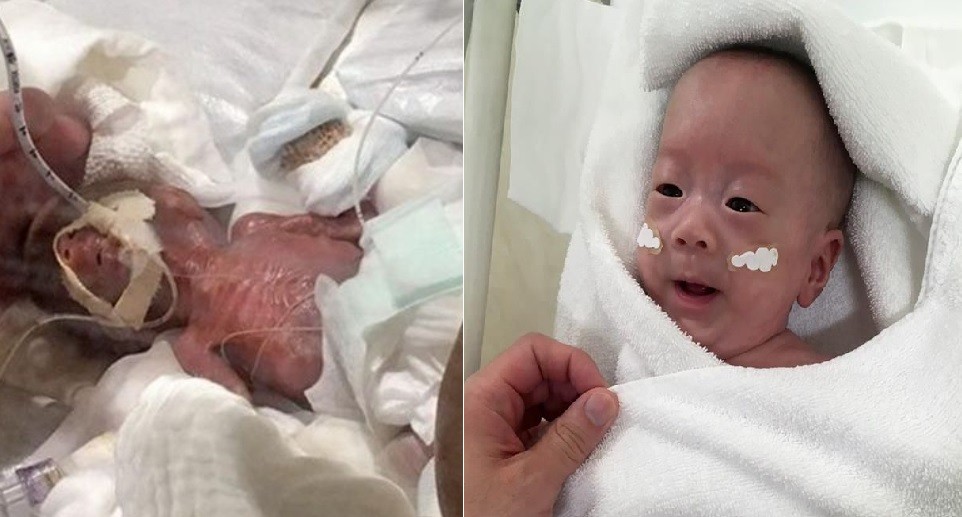 "No creía que pudiera sobrevivir": salió del hospital el bebé que nació con 268 gramos | Internacionales