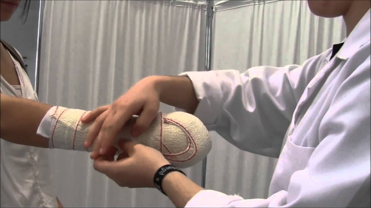 Joven de 21 años se amputó la mano con una sierra para cobrar el seguro de invalidez | Internacionales