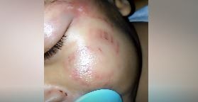 Madre denuncia grave maltrato a su bebé en una guardería infantil | Redes